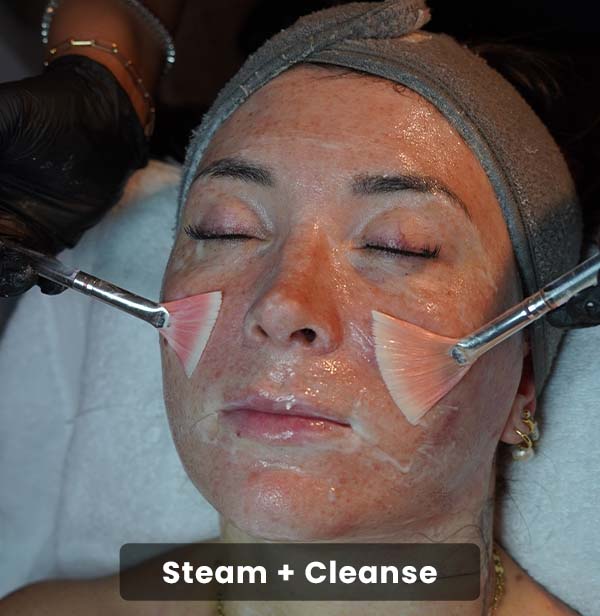 Cras tristique purus non lacus