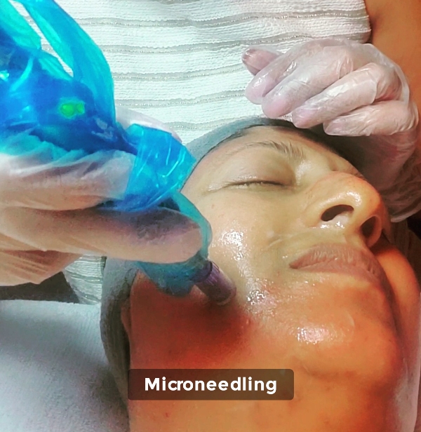 Cras tristique purus non lacus