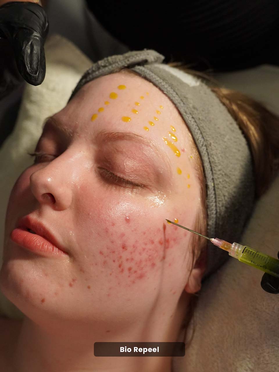 Cras tristique purus non lacus